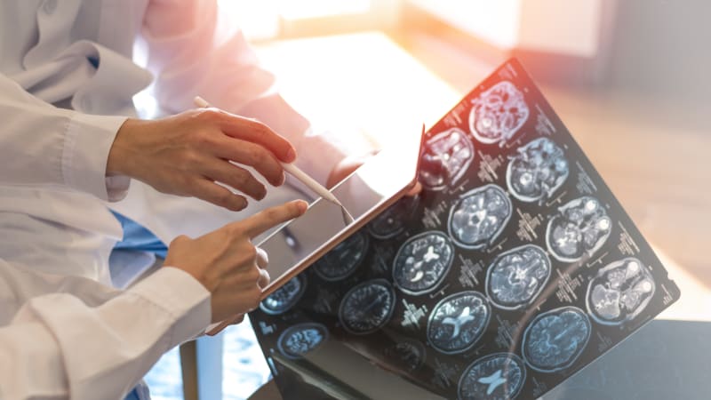 Nevyléčitelná nemoc, s níž bojuje Konečná: Vyvíjí se roky, napadá mladé. Jak se projevuje?