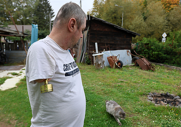 Novou ruku popálenému Jiřímu Hosovi vyrobí protetici z německého Passau